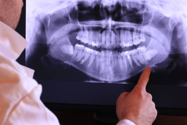 Best Orthodontic Emergency Dentist in Catoosa, OK