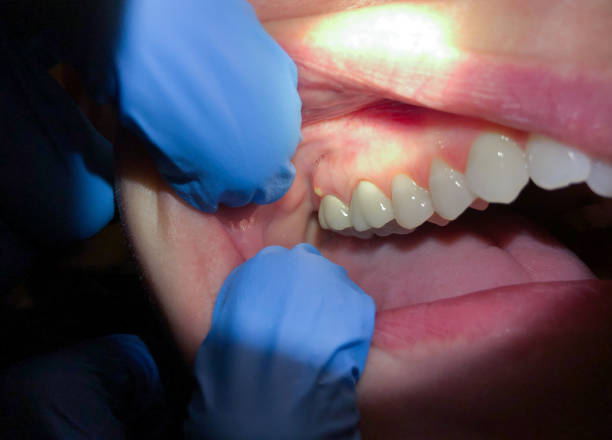 Best Broken or Cracked Tooth Emergency Dentist in Catoosa, OK