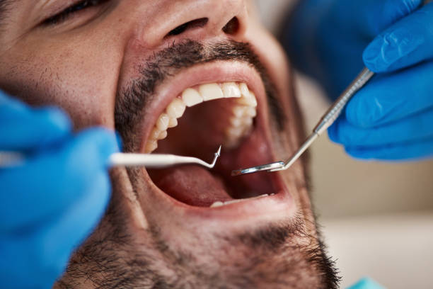 Best Emergency Cosmetic Dentistry in Catoosa, OK